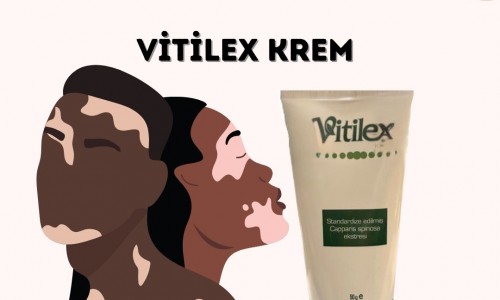 Vitilex Krem